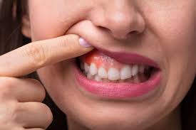 gum treatment in Gaur City 