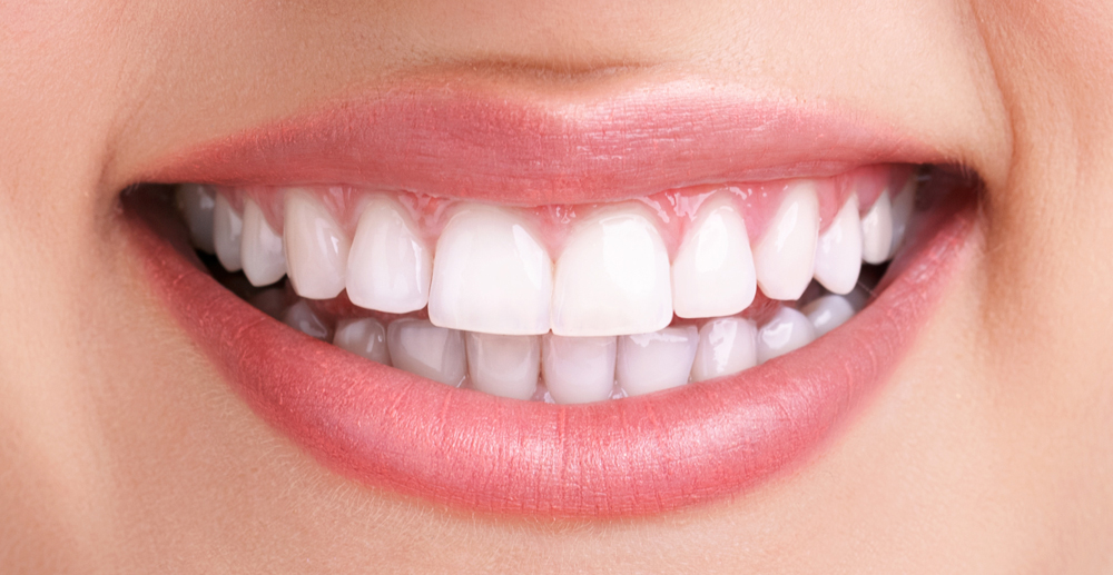 teeth whitening services in Gaur City 
