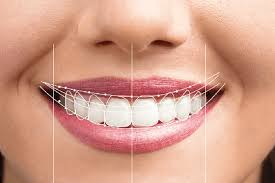 Cosmetic Dentistry
